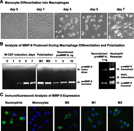 Figure 3. Induction of proMMP-9 during maturation and polarization of human macrophages. (A) Morphological changes during monocytes differentiation into macrophages. Freshly isolated monocytes were incubated in the presence of M-CSF for 7 days. Note a gradual change in the morphology from rounded monocytes to elongated cells, first noticeable on day 3 and representing almost all M0 macrophages by day 7. Images were acquired using an Olympus CKX-41 microscope equipped with Olympus U-LS30-3 video camera and Infinity Capture software and processed using Adobe Photoshop. Objective lens, ×20. (B) Kinetic analysis of proMMP-9 production during macrophage maturation and polarization. (Left) Gelatin zymography was conducted on serum-free (SF) medium conditioned by 2 × 104 human monocytes cultured in the presence of M-CSF for 7 days and then polarized into M1- or M2 macrophages. The position of 92-kDa proMMP-9 monomer and ∼200-kDa homodimer is indicated on the right. Human recombinant proMMP-9 was loaded to provide the means of quantification of proMMP-9 production. (Right) Zymographic analysis of granule contents released by 1 × 104 neutrophils. The position of 92-kDa proMMP-9 monomer, 125-kDa NGAL heterodimer, and ∼200-kDa homodimer is indicated on the right. Human recombinant proMMP-9 (3 ng per lane) was run to estimate the MMP-9 load in neutrophils. (C) Immunofluorescent analysis of MMP-9 expression in isolated neutrophils and monocytes and mature and polarized macrophages. Macrophages were differentiated from monocytes cultured on coverslips, whereas purified neutrophils and monocytes were directly placed on coverslips after cell isolation. The cells were fixed and then stained for human MMP-9 with mAb 8-3H (green). Cell nuclei were contrasted with 4′6 diamidino-2-phenylindole (blue). Images were acquired using a Carl Zeiss AxioImager M1m microscope equipped with AxioVision Re.4.6 software and processed using Adobe Photoshop. Objective lens, ×40.