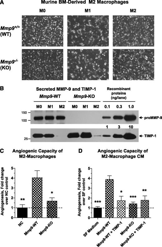 Figure 7. Angiogenic potential of murine BM-derived M2-macrophages depends on their TIMP-1-free proMMP-9. (A) Polarization of murine BM-derived macrophages. M0 macrophages were generated from WT mice (upper) or Mmp9-KO mice (lower) by incubation of BM cells in the presence of murine M-CSF. Following a 7-day maturation, M0 macrophages were incubated for 24 hours either in the mixture of IFNγ and LPS to induce the M1 phenotype or with IL-4 to induce the M2 phenotype. Phase contrast images were acquired using an Olympus CKX-41 microscope equipped with Olympus U-LS30-3 video camera and Infinity Capture software and processed using Adobe Photoshop. Objective lens, ×20. (B) Western blot analysis of MMP-9 and TIMP-1 produced by mature and polarized murine macrophages. Following maturation and polarization, murine macrophages were switched to SF medium. CM was collected 48 hours later and analyzed for production of MMP-9 and TIMP-1. Control proteins, murine recombinant proMMP-9 (105 kDa) and TIMP-1 (28 kDa), were loaded in the wells of the same gel to provide the means of quantification. After SDS-PAGE and transfer, the membrane was cut horizontally, and the upper potion was probed with anti-murine MMP-9 antibody, whereas the lower potion was probed with anti–TIMP-1 antibody. The position of molecular weight markers is indicated on the left. (C) Angiogenic capacity of murine M2 macrophages depends on expression of MMP-9. Intact M2 macrophages generated from BM of WT or Mmp9-KO mice were incorporated into 3D collagen onplants and analyzed in the CAM angiogenesis assay. SF medium was used as a negative no-cell (NC) control. The data are from 2 independent experiments, each involving from 4 to 6 embryos, each bearing from 5 to 6 onplants. Bar graph presents means ± SEM of fold changes in the levels of angiogenesis compared with NC control (1.0). *P < .05 and **P < .01 in comparison with angiogenesis levels induced by WT M2 macrophages. (D) Angiogenic capacity of murine M2 macrophages is sensitive to TIMP-1. M2 macrophages generated from BM of WT or Mmp9-KO mice were incubated in SF medium for 48 hours. CM was incorporated into 3D collagen onplants alone or with 4 ng of recombinant murine TIMP-1 per onplant. SF medium was used as a negative control. Data are from 2 independent CAM experiments, each involving from 4 to 6 embryos per variant (5-6 onplants per embryo). Bar graph presents means ± SEM of fold changes in the levels of angiogenesis compared with SF control (1.0). *P < .05, **P < .01, and ***P < .0001, all in comparison with angiogenesis levels induced by WT M2 macrophages.