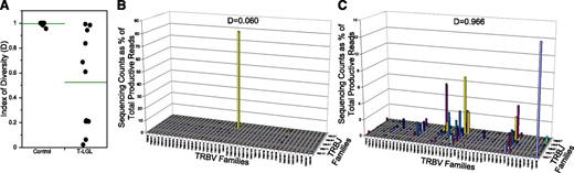 Figure 3. Index of diversity. Diversity scores were calculated for deep-sequencing TCR repertoire data from patients with T-LGL leukemia (n = 11; A, right) compared with healthy controls (n = 24; A, left) and analyzed by the Wilcoxon nonparametric method (P < .0001). Index of diversity and TCR repertoire plots for a T-LGL patient before therapy, D = 0.060 (B), and following complete remission, D = 0.966 (C). Note differences in y-axis values between panels B and C.