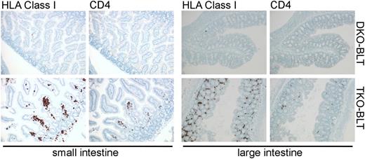 Immunostained sections of intestine taken from DKO- and TKO-BLT mice that show substantial repopulation of the lamina propria by human cells, including CD4+ T cells, in the TKO-BLT model.