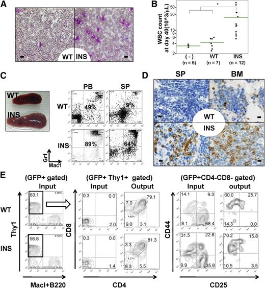 Figure 1. In vivo transforming activity of INS. (A-D) Lin− cells were retrovirally transduced with mock vectors (mock), WT, or INS, followed by injection into lethally irradiated congenic mice. (A) May-Giemsa staining of PB smears at day 40, showing marked leukocytosis consisting predominantly of mature myeloid cells. (B) White blood cell count at day 40. *P < .05 (analysis of variance; INS vs WT or mock recipient mice). (C) FACS of the PB and SP at day 40, showing an increase in Mac-1+/Gr-1+ myeloid cells. (D) Immunohistochemical analysis (IHC) of SP and BM specimens by anti-myeloperoxidase, indicating an increase in the number of myeloid cells in INS recipient mice. Bars represent (A) 10 μm and (D) 20 μm. (E) Demonstration of in vivo reconstitutive capacity of hIL7R (WT/INS) transduced T-cell progenitors. Lin− kit+ stem/progenitor cells were cultured on OP9-DL1 stromal layer for 7days, supplemented with mIL7+ human Fms-like tyrosine kinase 3-ligand, which allowed them to differentiate into Thy1+CD25−CD44+DN1 immature T-cell progenitor fractions. These cells were retrovirally transduced with WT/INS vector. The resultant cells were allowed to expand on OP9-DL1 stroma for additional 7 to 10 days, and developed into CD25+CD44−DN3 immature T-cell progenitor fractions. These Thy1+ cells were green fluorescent protein (GFP)-sorted and intravenously injected into sublethally irradiated mice. The resultant GFP+ thymic seeding progenitors (denoted as “input”) in recipient mice of WT and INS at day 52 was shown (denoted as “output”).