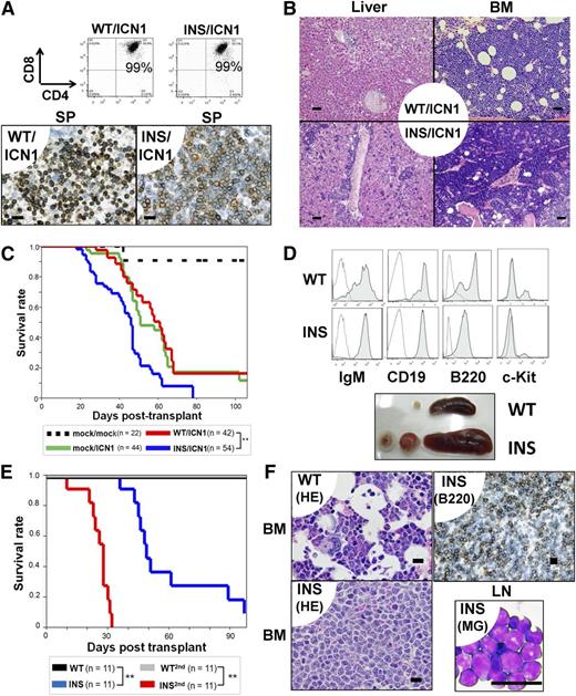 Figure 2. INS synergized with active Notch1 (A-C) and exerted transforming activity in CLPs (D-F) in vivo. (A-C) Lin− cells were cotransfected with vectors encoding the ICN1 gene (mock, ICN1) and the hIL7R gene (mock, WT, INS), followed by injection into lethally irradiated congenic mice. (A, upper) FACS analysis of the SP from WT/ICN1 or INS/ICN1 recipient mice at day 40. Data were obtained from GFP+ (marker for the ICN1 gene) and rat CD2+ (marker for the hIL7R gene) fractions. (A, lower) IHC of SP specimens using anti-CD3 antibodies from WT/ICN1 (left) and INS/ICN1 (right) recipient mice. Bar represents 20 μm. (B) Histological findings of liver (left 2 panels) and BM (right 2 panels) from WT/ICN1 (upper) and INS/ICN1 (lower) recipient mice (hematoxylin and eosin stain). Bar represents 50 μm. (C) Survival curves of recipient mice (mock/mock, n = 22; mock/ICN1, n = 44; WT/ICN1, n = 42; INS/ICN1, n = 54) **P < .01 (log-rank test). (D-F) CLPs transfected with hIL7R constructs were expanded in vitro for 18 days and injected into sublethally irradiated congenic mice. (D, top 2 panels) FACS analysis of the BM: WT recipient mice at day 60 (WT) and INS recipient mice at day 60 (INS). Data are obtained from GFP+ gated fractions. Open histogram, isotype control; shaded histogram, specific staining. (D, lower) Splenomegaly and lymphadenopathy developed in CLPs-INS recipient mice at day 60 (denoted as “INS”). (E) Survival curves of recipient mice (n = 11 for each condition). **P < .01 (log-rank test, INS vs WT or INS vs INS2nd). (F) Histological findings: BM specimens from WT recipient mice (upper left) and INS recipient mice at day 60 by hematoxylin and eosin stain (lower left) or by IHC of B220+ cells (upper right). Lymph node cytospin from INS recipient mice at day 60 by May-Giemsa stain (lower right). Bar represents 20 μm. WT, WT primary recipients; INS, INS primary recipients; WT-2nd, WT day 30 BM secondary recipients; INS-2nd, INS day 30 BM secondary recipients.