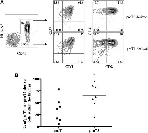 Figure 2. Analysis for the presence of proT1-derived and proT2-derived cells in the thymus of competitively reconstituted immunodeficient mice. (A) 1:1 mixture of sorted HLA-A2− proT1-cells (1 × 105) and sorted HLA-A2+ (1 × 105) proT2-cells were injected into nonirradiated NSG neonatal mice and the thymuses harvested and analyzed after 17 days (n = 7 mice/group). Shown is flow cytometric analysis of human CD45 and HLA-A2 cell surface expression and CD5, CD7, CD8, and CD4 expression on CD45+HLA-A2−– and CD45+HLA-A2+–gated cells for proT1- or proT2-derived cells, respectively. (B) Percentage of HLA-A2− or HLA-A2+ cells over total human CD45+ cells for individual mice shown. The results shown are representative of at least 3 independent experiments. *P < .05.