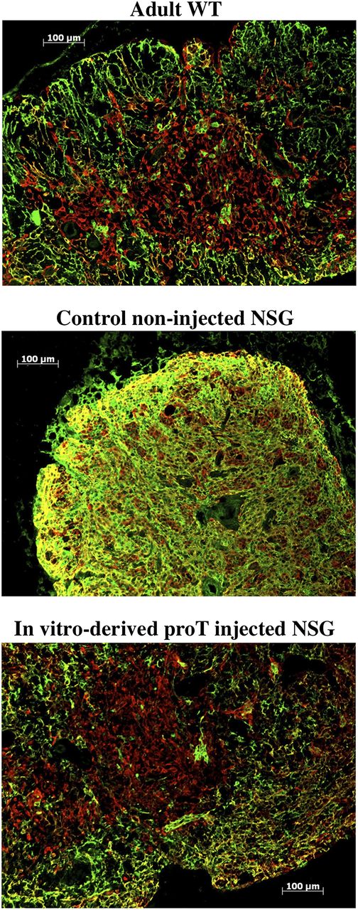 Figure 7. Immunohistologic analysis of thymus. Sections of the thymus from an adult WT mouse (top); control noninjected NSG mouse (middle); and in vitro–derived proT-injected NSG mouse (bottom) 6 weeks after intrahepatic injection into neonates (n = 6). Thymus tissues were stained with anti-Cytokeratin 8 (green; cortical) and anti-Cytokeratin 5 (red; medullary). The results shown are representative of 3 independent experiments.