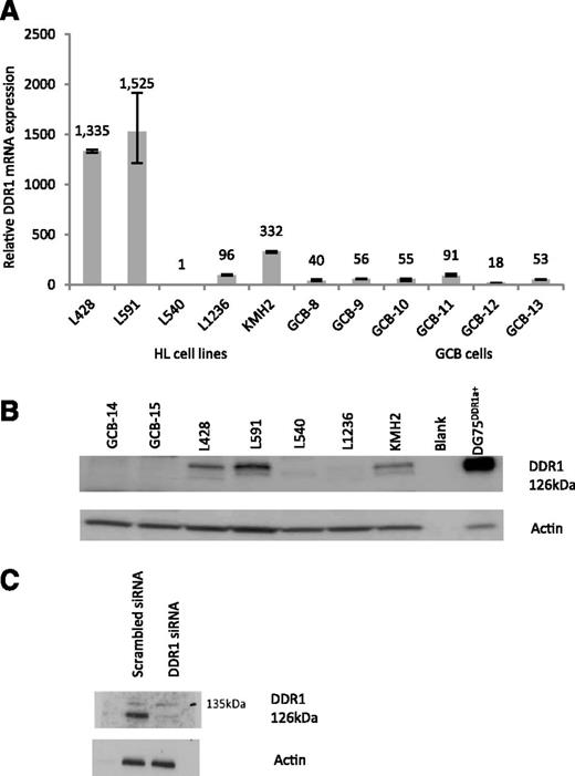 Figure 3. DDR1 is overexpressed in Hodgkin lymphoma cell lines. (A) A Q-RT-PCR assay which amplifies a sequence within the discoidin domain of DDR1 present in all known isoforms revealed that compared with GC B cells isolated from tonsils, DDR1 mRNA levels were higher in 4 of 5 Hodgkin lymphoma-derived cell lines. Normalized values were expressed relative to L540 set to a value of 1. (B) Immunoblotting for DDR1 in the same panel of cell lines showed the presence of a 126KDa protein at the expected weight of full length DDR1 and matched the levels of total DDR1 mRNA. Two representative GC B samples were DDR1 negative. DG75 cells transfected with DDR1 expression vector were used as a positive control. (C) Treatment of L591 cells with a pool of siRNAs, which recognizes all DDR1 isoforms, showed that the 126KDa band was decreased following inhibition by DDR1 RNA interference.