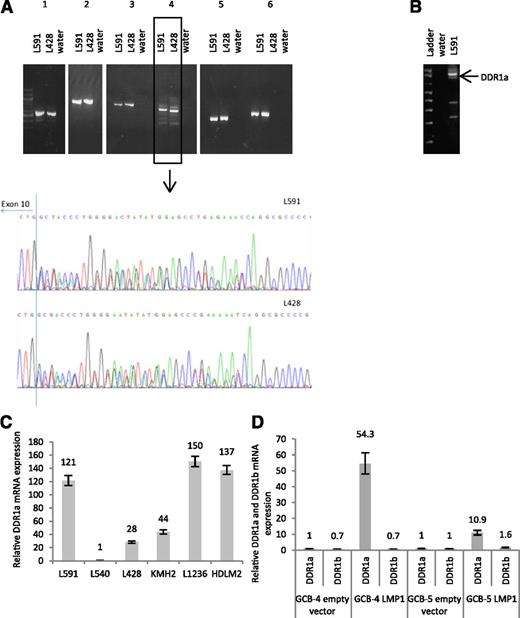 Figure 4. DDR1a is the major isoform expressed in Hodgkin lymphoma cell lines and is regulated by LMP1 in GC B cells. (A) PCR of cDNA from 2 representative Hodgkin lymphoma cell lines, L428 and L591 revealed the presence of a single band for 5 of 6 primer pairs spanning the coding region of DDR1. Multiple bands were detected by primer pair 4 spanning the entire juxtamembraneous domain. Sequencing of the PCR product of primer pair 4 revealed two overlapping sequences consistent with the presence of the DDR1a isoform and the DDR1d isoform. (B) To confirm these observations, a second set of primers was optimized to amplify only the juxtamembraneous domain. The amplified product was subjected to gel electrophoresis and individual bands sequenced from the gel. The strongest band present was found to correspond to the kinase-active DDR1a isoform. Transcripts for the kinase inactive form, DDR1d, as well as those encoding several potential novel isoforms were also present (supplemental Figure 3). Shown here are data from L591 cells, although similar results were obtained for L428 cells. (C) An isoform-specific Q-RT-PCR assay confirmed the expression of the DDR1a isoform in Hodgkin lymphoma cell lines. Normalized values were expressed relative to L540 set to a value of 1. (D) Q-RT-PCR analysis revealed that LMP1 increased the expression of DDR1a, but not the other kinase-active isoform, DDR1b, in human GC B cells. Normalized values were expressed relative to empty vector set to a value of 1.
