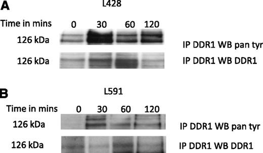 Figure 5. Collagen induces the phosphorylation and activation of DDR1 in HRS cells. (A) Detection of DDR1 phosphorylation in L428 cells, and (B) L591 cells with anti-phosphotyrosine antibody (4G10). The addition of collagen induced the robust phosphorylation of DDR1 in cells peaking at 30 minutes. Cell lysates were immunoprecipitated with anti-DDR1, and then probed with 4G10 or reprobed with anti-DDR1 antibody.