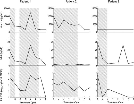 Figure 3. Distinct human and vIL-6 cytokine profiles during KSHV-MCD activity. Three representative patients illustrate the 3 h/vIL-6 flare patterns encountered (h+VIL-6, hIL-6 alone, and vIL-6 alone). Levels of vIL-6, hIL-6, and KSHV VL in are shown during their initial therapy. Periods where KSHV-MCD clinical manifestations were present are shaded gray. In all cases, KSHV VL is elevated during flares. Three distinct cytokine profiles are seen: vIL-6 and hIL-6 elevation (left); vIL-6 elevation without hIL-6 (center), and hIL-6 with undetectable vIL-6 (right).