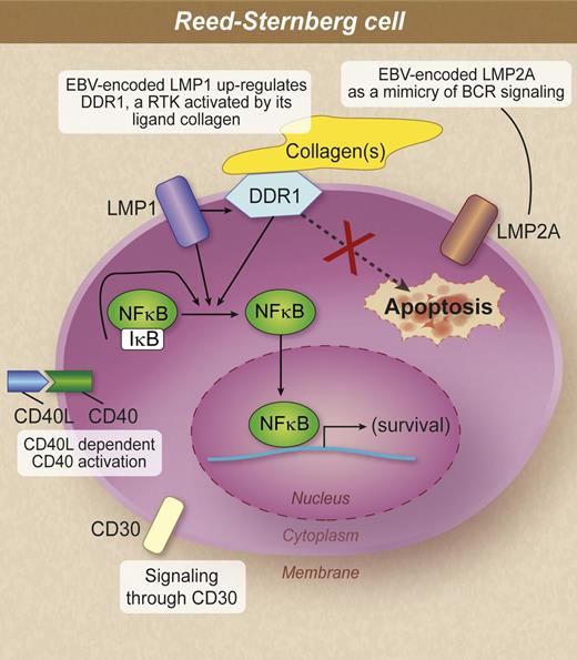 Molecules capable of promoting proliferation and survival and antiapoptotic mechanisms in RS cells. According to the study of Cader et al, in EBV-driven lymphomagenesis, the DDR1 pathway is likely to be an alternative or additional pathway to CD40 or CD30 signaling in the pathogenesis of Hodgkin lymphoma. IκB, inhibitory NF-κB. Professional illustration by Debra T. Dartez.