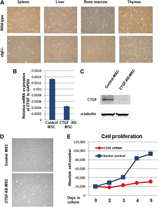 Figure 1. KD of CTGF expression inhibits proliferation of MSCs isolated from BM. (A) CTGF knockout or control pups were killed, and their stroma-rich body organs, including liver, thymus, spleen, and BM, were surgically dissected. Cell suspensions of these organs were cultured in α-minimum essential medium containing 20% fetal bovine serum fibroblast-like colony-forming units and were observed 7 to 10 days after plating in controls but not in CTGF knockout cells. (B) Normal MSCs derived from human BM were transduced with a lentivirus expressing CTGF shRNA. Data represent relative expression of CTGF to GAPDH in control and CTGF KD MSCs. (C) CTGF protein expression was analyzed in cell lysates from control and CTGF KD MSCs by western blotting with anti-CTGF antibody. α-Tubulin served as a loading control. (D) Morphology of control and CTGF KD MSCs. (E) Cell proliferation was analyzed by counting absolute cell numbers with a Vi-Cell XR cell counter. Control or CTGF KD MSCs (2 × 104) were cultured in 6-well dishes in triplicate and counted on days 2, 3, 4, and 5.
