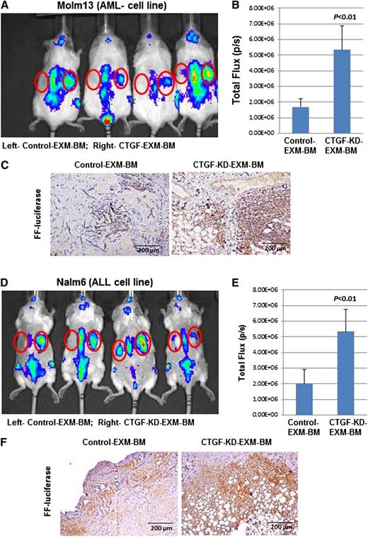 Figure 4. Leukemia cells specifically engraft into EXM-BM derived from CTGF KD MSCs. To investigate leukemia engraftment in EXM-BM derived from (left) control or (right) CTGF KD MSCs, the corresponding cells, in combination with endothelial progenitor cells and Matrigel, were transplanted subcutaneously into NOD/SCID/IL-2rγnull mice. Eight weeks later, (A-C) Molm13 or (D-F) Nalm6 cells (2 × 106) stably expressing firefly (FF) luciferase were transplanted intravenously into the mice harboring EXM-BM. (A,D) Two weeks after transplantation, the mice were imaged via the IVIS bioluminescence imager after injection of the luciferase substrate. The signal intensities were measured by the IVIS live imaging software package. (B,E) As an alternative, bone pellets were dissected and fixed in 4% paraformaldehyde, and the tissue sections were stained for immunohistochemical analysis with the anti-FF luciferase antibody. (C,F) The brown color indicates positive luciferase staining.