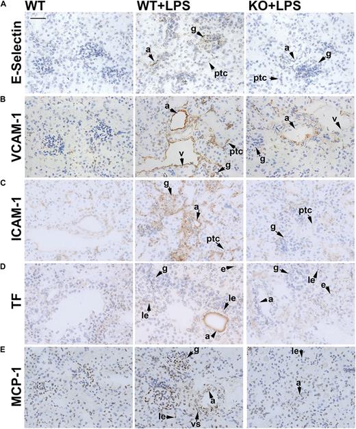 Figure 2. S1pr2 null mice exhibit less vascular inflammation in the kidney during endotoxemia. Expression of adhesion molecules and procoagulant and proinflammatory markers in kidneys from control WT, LPS-treated WT (WT + LPS), and LPS-treated S1pr2−/− (KO + LPS) mice 18 hours after administration of vehicle or LPS. Immunostaining for (A) E-selectin, (B) VCAM-1, (C) ICAM-1, (D) TF, and (E) MCP-1. Scale bar, 50 μm. Representative fields from 3 to 5 mice are shown. Images were captured with the Axio Imager A1 microscope, using AxioCam MRc camera and the AxioVision 4.8 program (Carl Zeiss Inc.) (original magnification ×40). a, arteriolar endothelium; e, epithelial cell; g, glomerulus; le, leukocyte; ptc, peritubular capillary; v, venule; vs, vascular smooth muscle cell.
