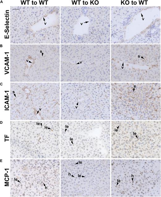 Figure 5. Immunohistochemical analysis of proinflammatory markers in livers from chimeric mice. Immunostaining for (A) E-selectin, (B) VCAM-1, (C) ICAM-1, (D) TF, and (E) MCP-1 in livers from LPS-treated S1pr2+/+ → S1pr2+/+, S1pr2+/+ → S1pr2−/−, and S1pr2−/− → S1pr2+/+ mice 18 hours after LPS injection. (A-C) Note that immunoreactivity for adhesion molecules was markedly decreased in venules and liver sinusoids only in the S1pr2+/+ → S1pr2−/− mice compared with S1pr2+/+ → S1pr2+/+ mice. (D) TF immunoreactivity was also significantly lower in infiltrating leukocytes from the S1pr2+/+ → S1pr2−/− chimeras. (E) Significantly lower levels of MCP-1 were detected only in hepatocytes and leukocytes from S1pr2+/+ → S1pr2−/− mice compared with S1pr2+/+ → S1pr2+/+ mice. Scale bar, 50 μm. Representative fields from 3 to 5 mice are shown. Images were captured with the Axio Imager A1 microscope, using AxioCam MRc camera and the AxioVision 4.8 program (Carl Zeiss Inc.) (original magnification ×40). h, hepatocyte; le, leukocyte; s, sinusoid; v, venule.