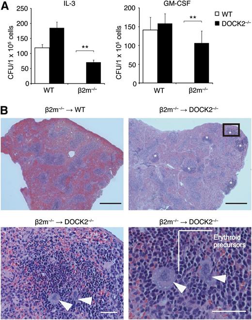 Figure 3. DOCK2 deficiency enables engraftment of MHC class I–deficient BM cells. (A) Four days after intravenous injection of WT or β2m−/− BM cells into lethally irradiated WT (n = 3) or DOCK2−/− (n = 3) mice, splenic CFU assays were performed in the presence of IL-3 (50 U/mL) or GM-CSF (50 U/mL). Data are expressed as the mean ± SD of 3 mice, and are representative of 2 independent experiments. **P < .01. (B) Four days after intravenous injection of β2m−/− BM cells into lethally irradiated WT or DOCK2−/− mice, splenic sections were stained with hematoxylin and eosin. Data are representative of 6 mice per category. Asterisks or arrowheads indicate extramedullary hematopoiesis or megakaryocytes, respectively. The lower panels indicate high-magnification images of the boxed area. Black bar, 500 μm; White bar, 50 μm.