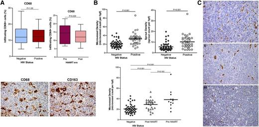 Figure 2. Tumor-infiltrating macrophages and angiogenesis in AR-DLBCL. (A) The proportion of CD68+ macrophages does not differ significantly between HIV-infected and uninfected patients, and between pre-HAART and post-HAART era patients (top). We noted comparable expression of CD68 and CD163 antigens by tumor-infiltrating macrophages in AR-DLBCL, as shown in this example (bottom). CD163 is a classic marker of anti-inflammatory or alternatively activated (M2) macrophages corresponding to the hemoglobin-haptoglobin scavenger receptor. (B) Microvessel and sprout densities for AR-DLBCL compared with sporadic DLBCL. AR-DLBCL is characterized by a substantially higher amount of neovascularization: the mean (±SD) microvessel and sprout count were 32.2 ± 13.2 per hpf and 10.2 ± 6.3 per hpf, respectively, whereas in sporadic DLBCL the corresponding values were significantly lower, 20.6 ± 8.3 and 5.5 ± 3.7 (P < .001 and P < .001, respectively). (C) Immunohistochemical analysis of CD34+ endothelial cells in 3 representative cases: (i) EBV-positive immunoblastic AR-DLBCL, (ii) EBV-negative centroblastic AR-DLBCL, and (iii) EBV-negative sporadic DLBCL centroblastic type, with respective microvessel counts of 52.22, 29.91, and 16.61 per hpf. All specimens represent lymph node biopsies of hyperproliferative lymphomas without c-Myc translocation. Images were taken with a Leica DM2500 microscope (original magnification, ×200), Leica DFC320 camera.