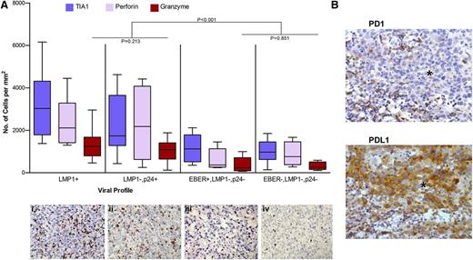 Figure 4. The infiltration of AR-DLBCL by CTLs is determined by the viral profile of the tumor. (A) The number of cytotoxic cells against the viral profiles. Cases with viral antigen expression (LMP1 and/or p24) show a substantially higher infiltration by cytotoxic cells than those lacking viral antigens. The P values correspond to activated (granzyme-positive) CTL. Immunohistochemical analysis for granzyme of 4 representative biopsy specimens with different viral profiles: (i) LMP1+ AR-DLBCL, (ii) LMP1−, p24+ AR-DLBCL, (iii) EBER+, LMP1−, p24−, and (iv) EBER−, LMP1−, p24− AR-DLBCL. (B) Additional immunosuppressive pathways in AR-DLBCL: PD1-PDL1 interaction. PD1-positive reactive lymphocytes are adjacent to, but also present within, the tumor whereas tumor cells demonstrate strong expression of the PD1 ligand, PDL1; *infiltrating sheets of tumor. Images were obtained with a Leica DM2500 microscope (original magnification, ×400), Leica DFC320 camera.