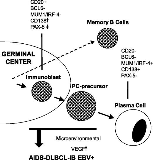 Figure 1. EBV-positive AIDS-related DLBCLs of the immunoblastic type display a phenotype related to plasma cells. The tumor cells display immunoblast-associated antigens together with plasma-cell–associated markers. The figure also shows the putative role of EBV in the microenvironmental angiogenesis by inducing vascular endothelial growth factor (VEGF) upregulation.