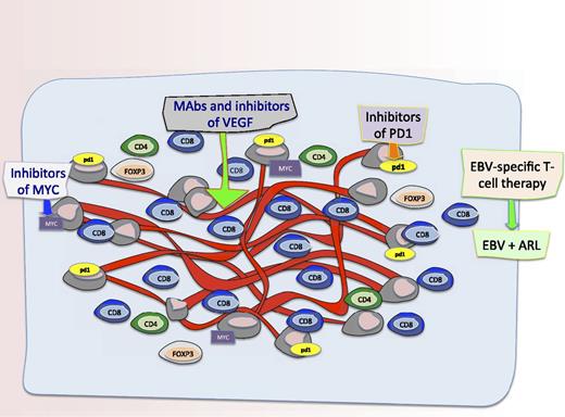 The microenvironment and novel targets in AR-DLBCL. Schematic representation of the microenvironment and potential novel targets in AR-DLBCL. Liapis and colleagues found differences in angiogenesis and the tumor microenvironment in cases of AR-DLBCL compared with sporadic cases. Specifically, they show that AR-DLBCL has PDL1 expression on tumor cells, increased hyperproliferation and c-Myc rearrangements, reduced CD4+ and FOXP3+ T cells, and increased activated CD8+ T cells. Moreover, there was more angiogenesis and higher numbers of CD8+ T cells in patients with AR-DLBCL expressing LMP1 and/or p24 compared with cases lacking viral antigens which has some implications for therapies to augment the immune response and/or targeting the vasculature. Therefore, as shown in this figure, potential therapeutic targets for this disease include T cells targeting EBV proteins LMP1 and LMP2 as well as antibodies and inhibitors of Myc, VEGF, and PD1.
