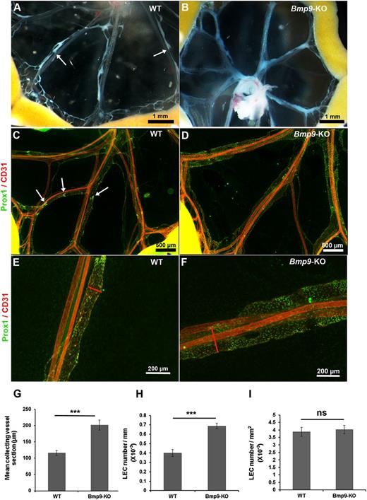 Figure 1. Abnormal structure of lymphatic mesenteric collecting vessels in Bmp9-KO neonates at P0. Representative macroscopic views of mesenteric vessels in WT (A) and Bmp9-KO (B) pups at P0. The lymphatic vessels are filled with white chyle and constrictions along the vessels reflecting the presence of valves are shown with white arrows. Whole-mount fluorescence immunostainings of WT (C) and Bmp9-KO (D) mesenteries with CD31 (red) and Prox1 (green); arrows point to Prox1-overexpressing cells in valve areas. Higher magnification views of the mid-part of mesenteric collecting vessels in WT (E) or Bmp9-KO (F). Enlarged vessels, as outlined by the red lines, showing vessel sections are observed in mutants. (G) Quantification of the mean collecting vessel section in WT and Bmp9-KO pups. The mean diameter of mesenteric lymphatic collecting vessels was calculated as the average of 4 different measurements performed using Axiovision 4.8 software throughout the length of 4 different collecting vessels per mesentery. (H-I) Quantification of LEC number per millimeter of collecting vessel length and by square millimeter of collecting vessel surface unit in WT and Bmp9-KO pups. Prox1-positive nuclei were counted per vessel unit length and per vessel surface unit on at least 3 collecting vessel per mesentery using Axiovision 4.8 software. Values are the mean (± SE) from 8 individuals per genotype. ns, not significant; ***P ≤ .001, significantly different from WT pups by unpaired Student t test.