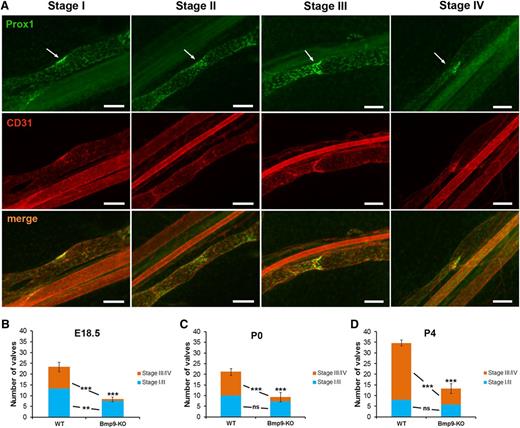Figure 3. Defective lymphatic valve formation in Bmp9-KO embryos and neonates. (A) WT P0 lymphatic mesenteric collecting vessels were stained for Prox1 (green) and CD31 (red) to allow the discrimination between the different valve maturation stages; arrows point to the valve location; bars, 100 µm. (B-D) Quantitative analysis of valve formation at E18.5, P0, and P4 in WT and Bmp9-KO mice. Values correspond to the number of valves counted on 4 collecting vessels per mesentery; n = 6 (Bmp9-KO) or n = 7 (WT) at E18.5; n = 8 (Bmp9-KO) or n = 9 (WT) at P0; n = 12 (Bmp9-KO) or n = 11 (WT) at P4. ns, not significant. **P ≤ .01, ***P ≤ .001, significantly different from WT pups by unpaired Student t test.