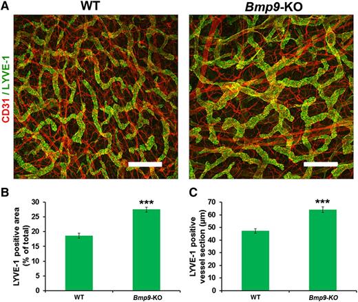 Figure 5. Abnormal patterning of ear lymphatic capillaries in adult Bmp9-KO mice. (A) Adult ear lymphatic capillaries were stained for LYVE-1 (green) and CD31 (red). Note that the LYVE-1 staining overlies weak CD31 staining in the lymphatic vessels. Bar represents 300 µm. (B) Quantification of the mean LYVE-1–positive area expressed as percentage of total area. The lymphatic vessel area in the inner layer of the ear of adult mice was measured using Image J software on images corresponding to 3 different fields of whole ear skin. These regions were kept constant for all samples. (C) Quantification of the mean LYVE-1–positive lymphatic vessel section expressed in micrometers. To quantify ear skin capillary mean lymphatic size, 5 horizontal lines were evenly laid on the images, and the diameters of lymphatic vessels that crossed these lines with an angle above 45° were measured using Image J according to Zhou et al.31 Values are mean ± SE; n = 8 for each genotype. ***P ≤ .001, significantly different from WT pups by unpaired Student t test.