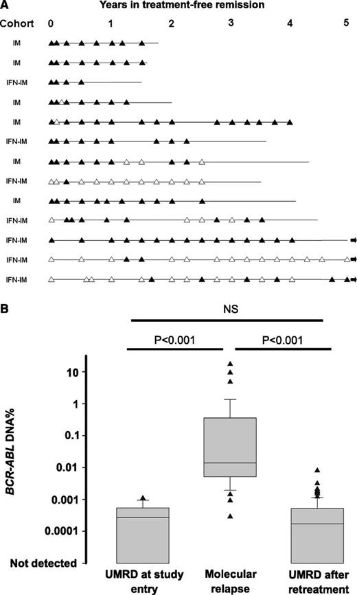 Figure 4. BCR-ABL DNA evidence of residual disease in patients with UMRD. (A) Results of BCR-ABL DNA monitoring for 13 patients in TFR. Solid triangles indicate that BCR-ABL DNA was detected; open triangles indicate that BCR-ABL DNA was not detected. The horizontal line shows the current period of follow-up for each patient. An arrow at the end of the line indicates that the patient remains in stable TFR with follow-up of more than 5 years. (B) The average level of BCR-ABL DNA for 13 patients who met the study definition of molecular relapse showing all results from patients with UMRD at study entry, all results at molecular relapse, and all results after regaining UMRD on IM re-treatment. Quantitative results are expressed relative to the individual patient’s baseline diagnostic sample. NS, not significant.