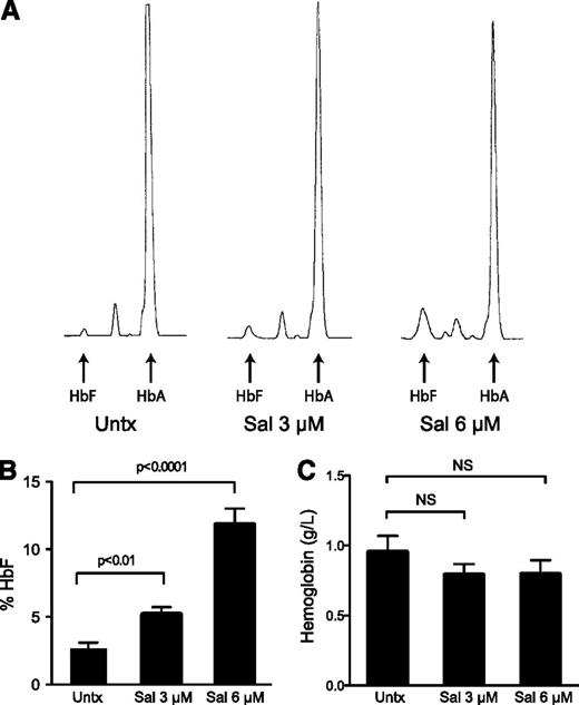 Figure 4. Salubrinal induces HbF in human erythroid progenitors. (A) Differentiating erythroid progenitors were treated with 3 μM and 6 μM salubrinal (Sal) on days 15 and 18 of the culture. On day 20, cells were lysed and the proportions of HbA and HbF were determined by ion-exchange HPLC. These HPLC traces from a representative experiment reveal that Sal enhances HbF, as well as it reduces HbA compared with the untreated control. (B) The percentage of HbF was quantified in 5 independent experiments (3 different donors) comparing 3 μM and 6 μM Sal treatments to an untreated control. Sal dose-dependently increases the percentage of HbF. Error bars express ± standard error of the mean and P values were calculated using an unpaired two-tailed t test. (C) Equal numbers of cells were lysed on day 20 and hemoglobin concentrations were determined by measuring the absorbance at 415 nm. Sal treatments did not significantly reduce total hemoglobin content. Error bars represent ± standard error of the mean of 5 independent experiments (3 unique donors). P values were calculated using an unpaired two-tailed t test and were found to be nonsignificant (NS). The P value for 3 μM and 6 μM Sal compared with untreated was P = .26 and P = .32, respectively.