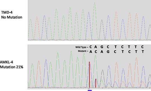 Figure 2. Chromatograms of DNA region of EZH2 harboring the mutation in AMKL4. Frameshift insertion p.D674_Y675 in EZH2 is absent in TMD (upper panel) and is present in AMKL (lower panel). Blue line, position of the insertion; vertical red lines, height of peaks of wild-type and mutant sequences.