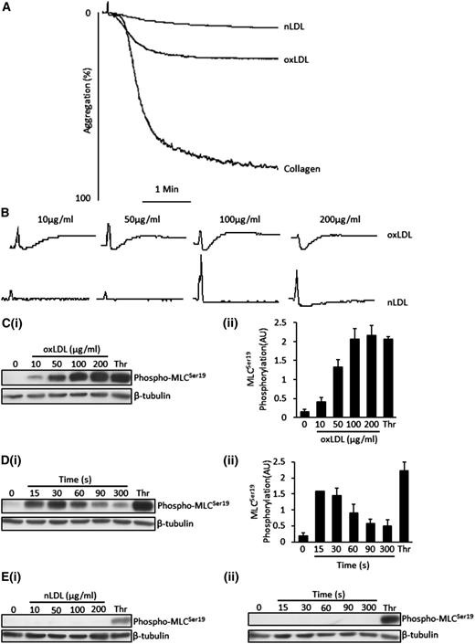 Figure 1. OxLDL induces platelet aggregation, platelet shape change and MLC phosphorylation. (A) Platelets (2.5 × 108/mL) were stimulated with nLDL (50 μg/mL), oxLDL (50 μg/mL), or collagen (10 µg/mL) for 4 minutes under stirring conditions. Shown are representative aggregation traces of 3 separate experiments. (B) Samples were processed as in (A), except that platelets were preincubated with apyrase (2 U/mL), indomethacin (10 µM), and EGTA (1 mM) followed by stimulation with either oxLDL or nLDL (0-200 µg/mL). Traces were recorded for 2 minutes. Shown are representative traces of 3 separate experiments. (C) Platelets (3 × 108/mL) were stimulated with varying concentrations of oxLDL (10-200 µg/mL) or thrombin (0.05 U/mL) for 15 seconds followed by lysis, separation by SDS-PAGE, immunoblot for phospho-MLCSer19, and reprobing for β-tubulin. (Ci) Representative blots. (Cii) Densitometric analysis of 3 independent experiments. (D) Platelets were incubated with 50 µg/mL of oxLDL for various time points (15-300 seconds) or thrombin (0.05 U/mL) for 15 seconds before lysis. Samples were then processed as in (C). (Di) Representative blots. (Dii) Densitometric analysis of 3 independent experiments. (Ei) Samples were processed as in (C), except that platelets were stimulated with nLDL. (Eii) Samples were processed as in (D), except that platelets were stimulated with nLDL. All immunoblots are representatives of 3 separate experiments and were carried out in the presence of apyrase (2 U/mL), indomethacin (10 µM), and EGTA (1 mM). Data are expressed as mean ±SEM.