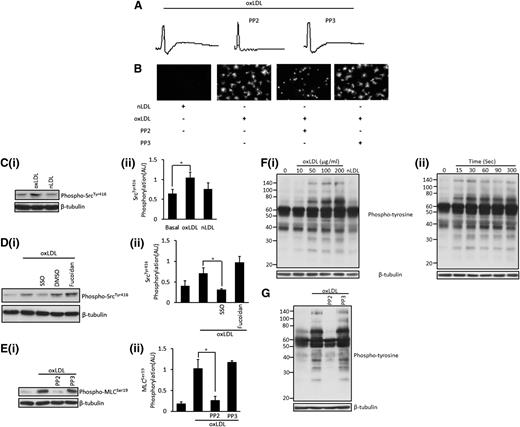 Figure 4. OxLDL induces the activation of Src kinases, which leads to platelet shape change and the phosphorylation of MLC. (A) Platelets (2.5 × 108/mL) were treated with PP2 (20 µM) or PP3 (20 µM) for 20 minutes, followed by stimulation with oxLDL (50 µg/mL). Traces were recorded for 2 minutes. Shown are representative traces of 6 independent experiments. (B) Platelets (5 × 107/mL) were adhered to nLDL or oxLDL (50 μg/mL) slides in the presence or absence of PP2 or PP3 (20 μM) for 30 minutes and were viewed by fluorescence microscopy. Representative images of 3 independent experiments were taken under ×60 magnification. Bar = 20 µm. (C) Platelets (5 × 108/mL) were stimulated with either oxLDL (50 µg/mL) or nLDL (50 µg/mL) for 15 seconds. Samples were then lysed, separated by SDS-PAGE, and immunoblotted for phospho-SrcTyr416 followed by reprobing for β-tubulin. (Ci) Representative blots. (Cii) Densitometric analysis of 4 independent experiments. *P < .05. (D) Samples were processed as in (C), except that platelets were pretreated with SSO (50 μM) or fucoidan (5 μg/mL). (Di) Representative blots. (Dii) Densitometric analysis of 3 independent experiments. *P < .05. (E) Platelets (3 × 108/mL) were treated with either PP2 (20 µM) or PP3 (20 µM) for 20 minutes, followed by stimulation with oxLDL (50 µg/mL) for 15 seconds. Samples were then processed as in (C) and were immunoblotted for phospho-MLCSer19 followed by reprobing for β-tubulin. (Ei) Representative blots. (Eii) Densitometric analysis of 4 independent experiments. *P < .05. (F) Platelets (5 × 108/mL) were stimulated with (Fi) varying concentrations of oxLDL (10-200 µg/mL) or nLDL (50 µg/mL) for 15 seconds. (Fii) Platelets (5 × 108/mL) were incubated with 50 µg/mL of oxLDL for various time points (15-300 seconds) before lysis. Representative blots of 4 independent experiments are shown. (G) Platelets (5 × 108/mL) were treated with either PP2 (20 µM) or PP3 (20 µM) for 20 minutes, followed by stimulation with oxLDL (50 µg/mL) for 15 seconds. Samples (F-G) were then processed as in (B) and were immunoblotted for phosphotyrosine, followed by reprobing for β-tubulin. All experiments were carried out in the presence of apyrase (2 U/mL), indomethacin (10 µM), and EGTA (1 mM), and are representative of 3 independent experiments.