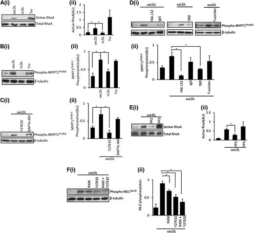 Figure 6. OxLDL, but not nLDL, induces the activation of RhoA and the inhibitory phosphorylation of MLCP. (A) Platelets (5 × 108/mL) were stimulated with oxLDL (50 µg/mL), nLDL (50 µg/mL), or thrombin (0.05 U/mL) for 15 seconds followed by lysis. Samples with then subjected to a RhoA activation assay, separated by SDS-PAGE and immunoblotted for RhoA. (Ai) Representative blots. (Aii) Densitometric analysis of 4 independent experiments. *P < .05. (B) Platelets (5 × 108/mL) were stimulated with oxLDL (50 µg/mL), nLDL (50 µg/mL), or thrombin (0.05 U/mL) for 15 seconds followed by lysis, separation by SDS-PAGE, immunoblot for phospho-MYPT1Thr853, and reprobing for β-tubulin. (Bi) Representative blots. (Bii) Densitometric analysis of 4 independent experiments. *P < .05. (C) Platelets (5 × 108/mL) were treated with Y27632 (10 µM) or BAPTA-AM (20 µM) for 20 minutes, followed by stimulation with oxLDL (50 µg/mL) for 15 seconds. Samples were then processed as in (B). (Ci) Representative blots. (Cii) Densitometric analysis of 4 independent experiments. *P < .05. (D) Platelets (5 × 108/mL) were treated with FA6.152 (1 μg/mL), SSO (50 µM), or fucoidan (5 µg/mL) for 20 minutes followed by stimulation with oxLDL (50 µg/mL) for 15 seconds and were processed as in (B). (Di) Representative blots. (Dii) Densitometric analysis of 3 independent experiments. *P < .05. (E) Platelets (5 × 108/mL) were treated with either PP2 (20 µM) or PP3 (20 µM) for 20 minutes, followed by stimulation with oxLDL (50 µg/mL) for 15 seconds. Samples were then subjected to a RhoA activation assay and were processed as in (A). (Ei) Representative blots. (Eii) Densitometric analysis of 3 independent experiments. *P < .05. (F) Platelets (3 × 108/mL) were preincubated with Y27632 (10 µM), R406 (1 µM), or a combination of Y27632 and R406 for 20 minutes followed by stimulation with oxLDL (50 µg/mL) for 15 seconds and lysis. Samples were then separated by SDS-PAGE and were immunoblotted for phospho-MLCSer19, followed by reprobing for β-tubulin. (Fi) Representative blots. (Fii) Densitometric analysis of 3 independent experiments. *P < .05. Data are presented as mean ± SEM. Experiments were carried out in the presence of apyrase (2 U/mL), indomethacin (10 µM), and EGTA (1 mM).