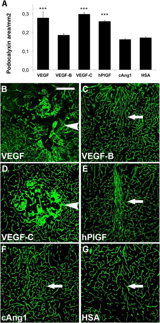 Figure 1. Effects of human vascular growth factor gene transduction on the brain vasculature. Immunostaining of the targeted brain regions 2 weeks after transduction. Quantification of (A) podocalyxin-positive areas. ***P < .001, when compared with HSA control; error bars show SD. (B-G) Examples of podocalyxin staining of (B) VEGF, (C) VEGF-B, (D) VEGF-C, (E) PlGF, (F) cAng1, and (G) HSA transduced brains. (B,D) Arrowheads point to hemangiomas. (C,E-G) Arrows point out needle path. Scale bar, 200 μm.