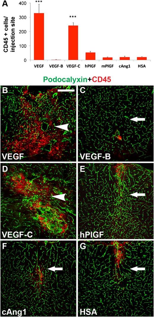 Figure 2. Inflammatory response after vascular growth factor expression. (A) Quantitative analysis of inflammation by CD45-positive cell counting per injection site. ***P < .001, when compared with HSA control; error bars show SD. (B-G) Immunostaining for CD45-positive cells (red), vascular counterstaining for podocalyxin (green). Scale bar, 200 μm.