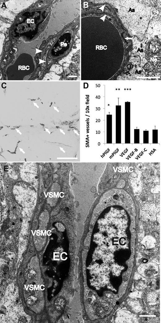 Figure 4. Electron microscopic evidence for mural cell recruitment after PlGF treatment. (A-B,D) Transmission electron microscopic images of vessels newly formed upon PlGF gene transfer. (A-B) Microvessels are surrounded by 2 layers of (endothelial and pericyte) basal laminae (arrowheads). (B) Capillaries are in intimate contact with the astrocytes (As); arrow points to tight junction between 2 endothelial cells. (C) SMA-positive vessels (arrow) after hPlGF gene transfer, for quantification. (D) Quantification of SMA-positive vessel density from immunostainings. *P < .05; **P < .01; and ***P < .001 when compared with HSA control; error bars show SD. (E) Arterioles are ensheathed in a single layer of VSMC. EC, endothelial cell; Ne, neuron; Pe, pericyte; RBC, red blood cell; VSMC, vascular smooth muscle cell. Scale bars: A-B,E, 1 μm; C, 200 μm.