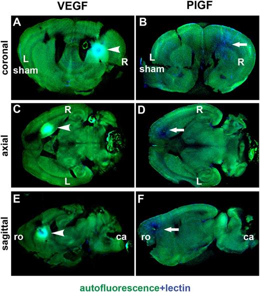 Figure 5. Evaluation of lectin extravasation with optical projection tomography. Right-sided growth factor injections were performed accompanied by left-sided sham operation. After VEGF gene transfer, major extravasation can be observed at the site of the hemangioma (arrowhead: A,C,E). PlGF gene transfer induced the formation of a dense microcapillary network, without significant extravasation (arrow: B,D,F). Autofluorescence is shown in green; lectin staining of blood vessels and extravasation in blue. ca, caudal; Ro, rostral.