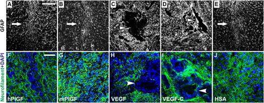 Figure 6. Effects of vascular growth factor treatment on the glial and neuronal structures. (A-E) Qualitative analysis of astrocytes by immunostaining for GFAP. Scale bar, 200 μm. (F-J) Qualitative analysis of neuronal structures by immunostaining for neurofilaments. Nuclear staining with DAPI. Scale bar, 50 μm. Arrows point out needle path (A-B,E). Arrowheads point to hemangiomas and its side effects in the (C-D) glial and (H-I) neuronal structures.