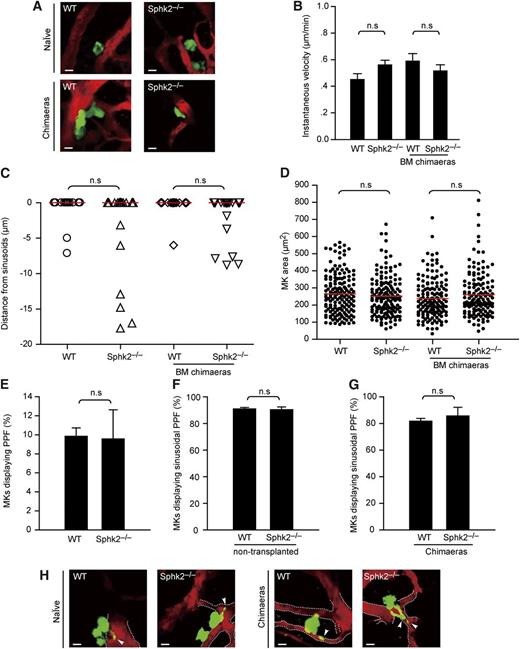 Figure 3. Loss of Sphk2 has no effect on positioning, motility, or size of MKs or PP formation. (A) Representative in vivo images of YFP+ MKs (green) and vasculature (red) in mouse BM. Images were captured through a ×20 water immersion objective lens with NA = 0.95 using a BioTech TriM Scope system. WT × CD41-YFPki/+ or Sphk2−/− × CD41-YFPki/+ naïve (nontransplanted) mice (upper row); WT × CD41-YFPki/+ or Sphk2−/− × CD41-YFPki/+ BM chimeric mice (lower row). (B) Instantaneous lateral (x-y) velocity of MKs. Data were pooled from 3 mice per group. (C) Distance of MKs from BM sinusoids. Red lines, medians. Data were pooled from 3 mice in each group. (D) Surface area of MKs in femoral BM. Red lines, medians. Data were pooled from 3 mice per group. (E) The percentage of MKs displaying PP formation (PPF) (3 independent experiments performed in triplicate). (F) Intrasinusoidal PP formation in WT × CD41-YFPki/+ or Sphk2−/− × CD41-YFPki/+ naïve (nontransplanted) mice. MKs displaying intrasinusoidal PPF in vivo are presented as the percentage of all MKs carrying PPs (50-76 MKs per group, 3 independent experiments per genotype). (G) Intrasinusoidal PP formation in WT × CD41-YFPki/+ or Sphk2−/− × CD41-YFPki/+ BM chimeras mice. MKs displaying intrasinusoidal PPF in vivo represented as the percentage of all MKs displaying PPs (49 MKs per group, 3 independent experiments per genotypes). (H) Representative MP-IVM images of MKs with YFP+ PPs. Images were captured through a ×20 water immersion objective lens with NA = 0.95 using a BioTech TriM Scope system. Green, MKs and PP; red, sinusoids; arrowheads, intrasinusoidal YFP+ PPs. The dashed line highlights the sinusoids. All scale bars represent 20 µm. All error bars represent SEM.