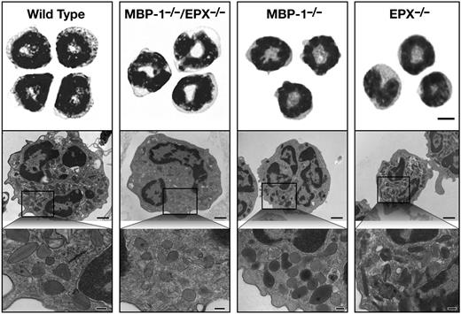 Figure 3. Peripheral blood leukocytes that have staining characteristics and subcellular morphologies consistent with eosinophils deficient in MBP-1 and EPX are present in MBP-1−/−/EPX−/− mice. Flow cytometric assessments of WBCs (supplemental Figure 3) from mice of each genotype (ie, wild-type, MBP-1−/−/EPX−/−, MBP-1−/−, and EPX−/−) were used to sort cells, isolating eosinophils that were subsequently cytospun onto slides and stained with a Romanowsky dye set (top panels). Scale bar = 5 µm. The electron microscopic morphology of the eosinophils that remain in MBP-1−/−/EPX−/− mice (lower panels) showed that these cells retain the membrane-bound vesicles (ie, granules) found in wild-type, MBP-1−/−, or EPX−/− mice. As expected, these granules appear devoid of their electron-dense cores (MBP-1) and much of the electron-translucent matrices (characteristic of EPX) of these granules. Scale bars in panels highlighted by a single eosinophil = 1 µm. Scale bars in the insert panels representative of the cytoplasm = 200 nm.