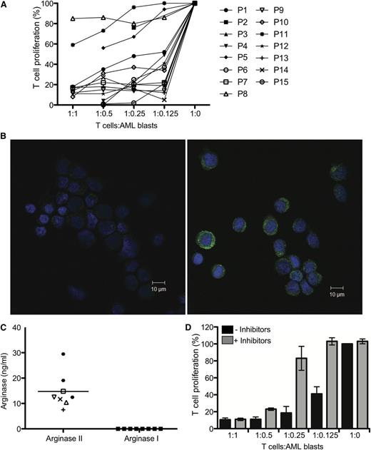 Figure 1. Arginine metabolism regulates the suppressive activity of AML blasts. (A) AML blasts from 15 patients were cultured with allogeneic T cells in a MLR. The ratio of AML cells:T cells ranged from 1:1 to 1:0. T-cell proliferation was measured by 3H-thymidine incorporation after 4 days. AML blasts from 12/15 patients strongly suppressed T-cell proliferation. Patients are identified by unique symbols, which are used consistently throughout the manuscript. (B) Expression of arginase II in blasts from patients with AML was confirmed by confocal microscopy. (Left) Staining with DAPI (nuclear stain) and secondary antibody alone; (right) staining with DAPI, anti-human arginase II antibody, and secondary antibody. Scale bar = 10 μm. (C) AML blasts release arginase II into the microenvironment. Supernatants from cultures (24 hours) of patients’ AML blasts were analyzed by ELISA for arginase II and arginase I (***P = .0001). (D) AML blasts from patients were cultured with allogeneic T cells in a MLR in the presence of the enzyme-specific inhibitors for arginase (NOHA) and iNOS (L-NMMA). The ratio of AML cells:T cells ranged from 1:1 to 1:8. T-cell proliferation was measured by 3H-thymidine incorporation after 4 days. Culture with the enzyme inhibitors restores T-cell proliferation. Data are representative of 5 independent experiments (error bars, SD).