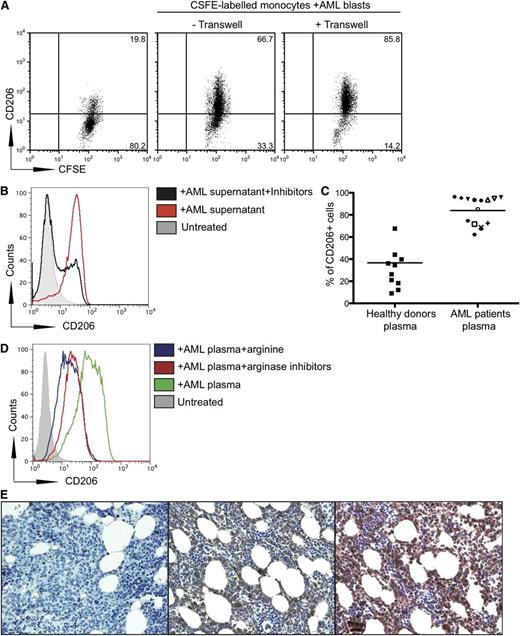 Figure 3. AML blasts increase CD206 expression on monocytes. (A) Transwell culture of CFSE-labeled monocytes from healthy donors with AML blasts from patients upregulates CD206 expression on monocytes. Monocytes from healthy donors were placed in the lower well and AML blasts from patients were placed in the upper well of a transwell assay system. Representative flow cytometry plots from 1 patient of 11 tested are shown. (B) Coculture of CFSE-labeled monocytes from healthy patients with supernatants (50% of final volume) from AML blasts upregulates CD206 on monocytes, as analyzed by flow cytometry. (C) Upregulation of CD206 on monocytes cultured with plasma of 15 patients with AML or 15 healthy donors (P < .0001). Percentage of CD206+ cells is shown. (D) Upregulation of CD206 on monocytes cultured with plasma of patients with AML with or without arginine (100 ng/mL) and inhibitors (0.5 mM). Data are representative of 3 independent experiments (E) Staining of bone marrow from patients with AML at diagnosis with anti-human CD206 (center), with DAPI alone (left), and with anti-arginase II (right). Representative marrow from a single patient with AML shown of 6 (samples obtained from University of Oxford Biobank).
