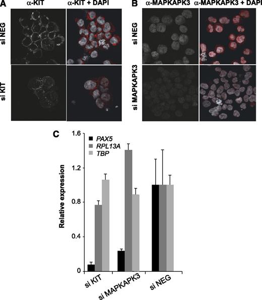 Figure 6. siRNA-mediated depletion of MAPKAPK3 and KIT signaling molecules downregulates PAX5 expression in Kasumi-1 cells. (A-B) Immunostaining showing KIT and MAPKAPK3 proteins (red), respectively, in Kasumi-1 cells after siRNA-mediated depletion. (siNEG) cells transfected with a control siRNA. (C) qRT-PCR showing expression of PAX5, RPL13A, and TBP relative to GAPDH in Kasumi-1 cells transfected with control siRNA (siNEG), MAPKAPK3 siRNA, and KIT siRNA. Values obtained with siNEG were set as one. The bar graph is representative of 2 independent experiments measured in duplicate; the error bars show variability in qPCR measurements.