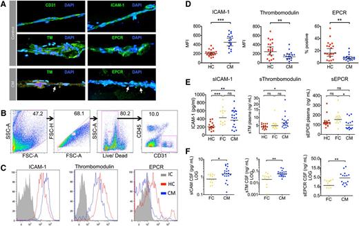 Figure 3. Endothelial activation and decreased EPCR and TM ex vivo in biopsies from children with CM. (A) Immunofluorescence-labeled needle biopsies samples of subcutaneous tissue from healthy children and children with CM. Nuclei appear blue (DAPI) and endothelial receptors green (Alexafluor 488). Micrographs (40× lens) show microvessels from healthy children as indicated by morphology, elliptical endothelial nuclei, and bright staining for CD31, ICAM-1, TM, and EPCR. Vessels from a CM case show IE sequestration (arrows) associated with low TM and EPCR staining. Needle biopsy samples were digested, labeled, and then analyzed by flow cytometer to examine the receptor expression of endothelial cells from microvessels in the sample. (B) Flow cytometry gating strategy for samples to distinguish endothelial cells as single, live, CD31+CD45− cells. (C) Histograms for 3 different endothelial receptors: ICAM-1, TM, and EPCR; representative plots from a single case for CM (blue), healthy children (HC; red), and antibody isotype control (IC, gray). ICAM-1 and TM staining show low overlap with the isotype control and receptor expression was determined by mean fluorescence intensity (MFI), whereas EPCR staining overlapped considerably with the isotype and expression was determined by percentage positive events. (D) Scatterplots for the endothelial expression levels of ICAM-1, TM, and EPCR as determined by flow cytometry in 17 CM cases and 20 HCs. (E) Scatterplots for levels of soluble ICAM-1, soluble TM, and soluble EPCR as determined by enzyme-linked immunosorbent assay in plasma samples in HC, CM, and aparasitemic febrile controls (FC) who were noncomatose patients that had a lumbar puncture taken because of clinical suspicion of meningitis. (F) Scatterplots for levels of soluble ICAM-1, soluble TM, and soluble EPCR in paired CSF samples in FC and CM; CSF samples were not taken from healthy children. Horizontal lines indicate geometric means and bars 95% CIs. Significance determined by one-way analysis of variance with the Tukey honestly significant difference test to adjust for multiple comparisons in E. * P < .05, ** P < .01, *** P < .001. Fluorescence micrographs were taken using a Leica DM1L microscope and a Leica DFC300FX camera using Leica Application Suite version 2.6.0 software.