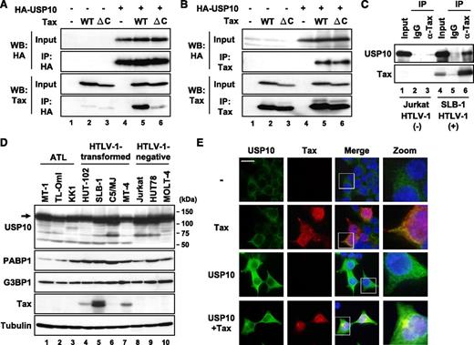Figure 1. Tax interacts with USP10. (A,B) 293T cells were transfected with a control plasmid (lanes 1, 4), Tax plasmid (lanes 2, 5), or TaxΔC plasmid (lanes 3, 6) together with (lanes 4-6) or without (lanes 1-3) an HA-USP10 plasmid. At 48 hours after transfection, the cell lysates were immunoprecipitated with anti-HA (A) or anti-Tax (B) antibodies, and the total lysates (input) and immunoprecipitates (IP) were characterized using a western blot analysis with anti-HA and anti-Tax antibodies. TaxΔC has a 4 amino acid deletion on the Tax C-terminus, the peptide of which is missing in the nonleukemogenic HTLV-2 Tax2, because the original goal was to isolate binding factors specific to Tax but not to Tax2. (C) The cell lysates prepared from HTLV-1–uninfected T cells (Jurkat; lanes 1-3) and HTLV-1–infected T cells (SLB-1; lanes 4-6) were immunoprecipitated with anti-Tax antibodies (lanes 3, 6) or control antibodies (lanes 2, 5). The input lysate and IP were characterized using a western blot analysis with anti-USP10 and anti-Tax antibodies. (D) Cell lysates were prepared from 7 HTLV-1–infected T-cell lines (lanes 1-7) and 3 HTLV-1–uninfected T-cell lines (lanes 8-10). The expressions of USP10, PABP1, G3BP1, Tax, and α-tubulin proteins were determined using a western blot analysis with the corresponding antibodies. (E) 293T cells were transfected with a Tax plasmid together with or without the HA-USP10 plasmid. The transfected cells were stained with anti-USP10 (green) and anti-Tax (red) antibodies. The nuclei were counterstained with Hoechst33258 (blue). The bar indicates 20 μm.