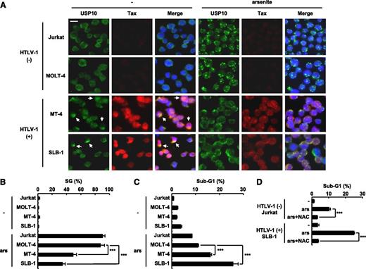 Figure 6. The level of arsenite sensitivity of HTLV-1–infected T cells correlates with the level of SG-forming activity. (A,B) HTLV-1–uninfected (Jurkat and MOLT-4) and HTLV-1–infected (SLB-1 and MT-4) T cells were treated with 0.5 mM of sodium arsenite for 30 minutes and then were stained with anti-USP10 antibodies (green), anti-Tax antibodies (red), and Hoechst33258 (blue). The arrows indicate cells with colocalization of USP10 and Tax. The bar indicates 10 μm in (A). The SG (%) in the indicated cells is presented in (B). (C) HTLV-1–uninfected (Jurkat and MOLT-4) and HTLV-1–infected (MT-4 and SLB-1) T cells were treated with 5 μM of sodium arsenite for 48 hours and then were stained with PI. The proportion of the sub-G1 population (apoptotic cells) was measured using flow cytometry. (D) Jurkat and SLB-1 cells were incubated with or without 10 mM of NAC, further treated with 5 μM of sodium arsenite for 48 hours, and stained with PI. The proportion of sub-G1 populations (%) was measured using flow cytometry. In all experiments, the values denote mean ± SD; ***P < .001.