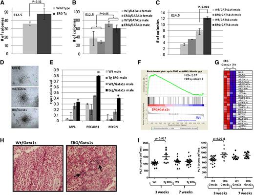 Figure 3. ERG synergizes with Gata1s to promote transient megakaryocytic proliferation presenting a human TMD expression profile. (A-C) FL cells were isolated from E12.5 (A-B) and E14.5 (C) wild-type, TgERG embryos and males and females of Wt/Gata1s and ERG/Gata1s embryos. The cells were plated on methylcellulose supplemented with TPO to promote the growth of megakaryocytic colonies (CFU-MK). MK colonies were counted 5 to 7 days following plating. Each bar graph represents the average of at least 3 independent experiments. (D) Representative figure of megakaryocytic colonies from (top) TgERG, (middle) Wt/Gata1s, and (bottom) ERG/Gata1s FLs. (E) Real-time PCR of common human TMD genes (11). *Statistical significance was tested using the t test (P = .028 for Mpl; P = .009 for Pecam1; and P = .0 for Mycn). (F) Gene set enrichment analysis (GSEA) using gene expression of E14.5 ERG/Gata1s FL cells (GSE46481) compared with the respective Wt control shows significant enrichment of genes that were upregulated in human TMD (GSE4119). NES and FDR q values are shown. (G) Heat map showing the core enrichment genes from the GSEA presented in panel F. (H) Hepatic fibrosis in ERG/Gata1s male FL. Reticulin staining (arrowheads) of (left) Wt/Gata1s and (right) ERG/Gata1s FL tissues (magnification, ×400). (I) Transient thrombocytosis in TgERG and ERG/Gata1s mice. Platelet counts were retrieved from male and female TgERG and ERG/Gata1s and their Wt and Wt/Gata1s littermates at 3 and 7 weeks of age; n= at least 6 for each group. A significant difference was found between TgERG and Wt and between ERG/Gata1s and Wt/Gata1s (t test: P < .017, P < .0031, respectively). FDR, false detection rate; NES, normalized enrichment score.
