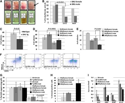 Figure 4. Requirement of the N terminus of GATA1 in fetal erythropoiesis. (A) Representative pictures of E14.5 embryos. The FL of ERG/Gata1s males is smaller and paler (arrow). A total of 1 × 107 FL cells were resuspended in PBS. The light color of the ERG/Gata1s FL cells points to the decrease number in mature erythrocytes in those embryos. (B) ERG/Gata1s males die between E12.5 and E14.5. Females and males generated from crossing heterozygous TgERG males with homozygous Gata1s KI females were tested for the presence of ERG transgene on E12.5, E14.5, and adults (n = 85, 98, and 137 for E12.5, E14.5, and adults, respectively). A significant difference in the TgERG male population was found between E12.5 and E14.5 (t test: P < .014). (C-E) ERG and Gata1s inhibit erythroid colony formation. FL cells were isolated from (C) E12.5 TgERG embryos and Wt littermates and (D-E) E12.5 and E14.5 embryos of ERG/Gata1s embryos and Wt/Gata1s littermates and were plated on methylcellulose supplemented with EPO to promote growth of erythroid colonies (BFU-E). Erythroid colonies (BFU-E) were counted 7 to 10 days after plating. Each bar graph represents the average of at least 3 independent experiments. Statistical significance was tested using the t test. (F) Representative figures of flow cytometric analysis of male E12.5 FL cells using the erythroid markers Ter119 and CD71. (G) Expression of Gata1s impairs erythropoiesis. Expression of Ter119 erythroid marker as measured by flow cytometry analysis in FL cells generated from E12.5 females and males of Wt, TgERG, Gata1s, and ERG/Gata1s animals. (H) Increase apoptosis in ERG/Gata1s males. Annexin V levels were measured by flow cytometry in Ter119-positive FL cells for the detection of apoptosis. FL cells were isolated from E12.5 Wt, TgERG, Wt/Gata1s, and ERG/Gata1s males. Significant increase in apoptosis in ERG/Gata1s males compared with Wt/Gata1s males was measured using the t test (P = .017). (I) Decreased expression of erythroid and antiapoptotic genes in ERG/Gata1s males. Expression level of the different genes was obtained from the Affymetrix mouse gene 1.0 ST chip array and confirmed by real-time PCR on at least 2 additional samples for each genotype.