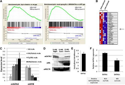 Figure 6. ERG/Gata1s FL cells present an early erythroid expression profile. (A) GSEA using gene expression of human erythroid cells at different stages of differentiation38 shows enrichment of Wt/Gata1s and ERG/GATA1s E14.5 FL gene signature (GSE46481) in early erythroid cells. (B) Heat map showing the top 20 core enrichment genes from the GSEA presented in panel A, right. (C) Expression level of Gata2 and Myb genes as obtained from the mouse gene 1.0 ST chip array and confirmed by real-time PCR on at least 2 additional samples for each genotype. (D) Representative western blot from G1ME cells transduced with MigR1, MIGR1-GATA1, and MIGR1-GATA1s using the indicated antibodies. (E) Average difference in GATA2 expression from 3 independent G1ME expreriments presented in panel D. (F) An average repression of GATA2 mRNA by real-time PCR in E14.5 GATA1s KI FL cells infected with MIGR1-GATA1and MIGR1-GATA1s relative to MigR1-infected cells. Relative GATA1 and GATA1s RNA expression levels are indicated below (n = 3).