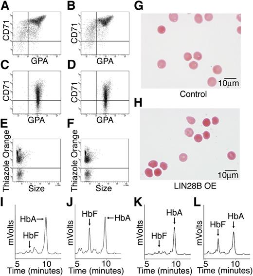 Figure 3. LIN28B overexpression enhances HbF levels in adult human erythroblasts. Flow cytometry analyses of (A) control and (B) LIN28B-OE at culture day 14, and (C) control, and (D) LIN28B-OE at culture day 21 stained with anti-transferrin receptor (CD71) and anti-glycophorin A (GPA) antibodies. Enucleation is represented by staining of culture day 21 cells with thiazole orange for (E) control and (F) LIN28B-OE. The enucleated cells were imaged in panels (G) control and (H) LIN28B-OE. HPLC analysis of hemoglobin from (I) control and (J) LIN28B-OE, and (K) control and (L) LIN28A-OE samples performed at culture day 21 shown for comparison with LIN28B-OE. HbF and HbA peaks are labeled on each graph (y-axis: mVolts; x-axis: elution time in minutes). Data are representative of more than 3 independent experiments. LIN28B-OE, LIN28B overexpression; LIN28A-OE, LIN28A overexpression.