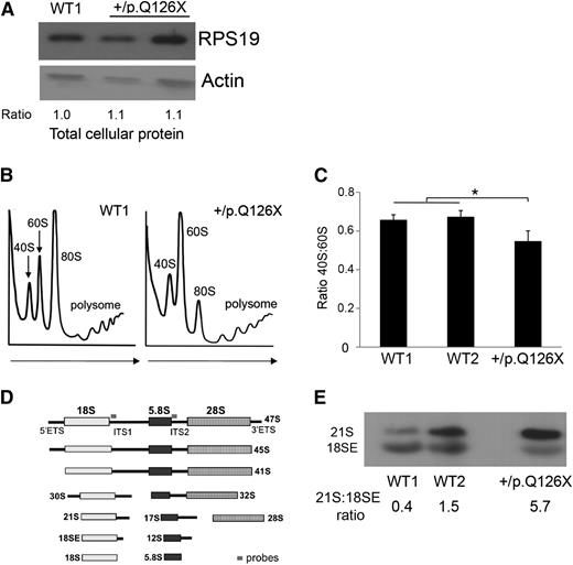 Figure 1. Ribosome biogenesis defects in RPS19+/p.Q126X iPSCs. (A) Western blot showing RPS19 protein in RPS19+/p.Q126X iPSCs and a WT (WT1) control line. Lane 2 represents the mutant iPSC line examined throughout this manuscript. Lane 3 represents an iPSC line that did not fulfill all of the pluripotency criteria and therefore was not examined further. Ratio of RPS19:actin determined by densitometry is shown relative to the value for the WT1 sample, which was assigned an arbitrary value of 1.0. (B) Sucrose gradient polysome profiles showing reduced 40S:60S ratio in RPS19+/p.Q126X iPSCs compared with a WT control line. Arrows show direction of the sucrose gradient from less to more dense. (C) Histogram summarizing 3 independent polysome profiling experiments examining RPS19+/p.Q126X iPSCs and 2 different WT lines. The 40S:60S ratio was significantly reduced in the mutated clone (0.55 vs 0.66, *P < .05). (D) Diagram showing rRNA maturation and Northern blot probes complementary to ITS1 (for the 40S unit) and ITS2 (for the 60S unit), used in Figures 1E, 4G, and 6D. The probe sequences are shown in supplemental Table 3. (E) Northern blot analysis of iPSCs using the ITS1 probe. RPS19+/p.Q126X iPSCs exhibit relative accumulation of 21S pre-rRNA compared with WT iPSCs. The 21S:18SE pre-rRNA ratios determined by densitometry scanning is shown at the bottom of the panels. ITS, internal transcribed spacer.