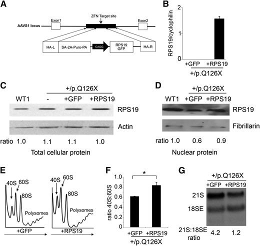 Figure 4. Genetic rescue of RPS19+/p.Q126X iPSCs restores 40S ribosomal subunit biogenesis. (A) Gene correction strategy. The constitutively active AAVS1 “safe harbor” locus is shown on the top line and the targeting construct is shown below. cDNA expression cassettes driving expression of WT RPS19 or GFP cDNAs under the chicken actin promoter (CAGG) were inserted by zinc finger-mediated homologous recombination into intron 1 of AAVS1. HA, homologous arms left (L) and right (R); SA-2A-Puro-PA, puromycin drug resistance cassette. (B) Quantitative RT-PCR analysis of AAVS1-targeted iPSCs using primers specific for transgenic RPS19 cDNA. Expression was detected specifically in RPS19+/p.Q126X iPSCs after heterozygous integration of the RPS19 cDNA into the AAVS1 locus. RPS19 expression is normalized to the cyclophilin expression level. (C) Western blot showing RPS19 protein in whole-cell lysates of WT1, RPS19+/p.Q126X parental iPSCs (designated as “ – ”) and RPS19+/p.Q126X clones with AAVS1-integrated GFP or RPS19 transgenes. The ratio of RPS19:actin determined by densitometry is shown relative to the WT1 sample, which was assigned an arbitrary value of 1.0. (D) Western blot showing RPS19 protein in nuclear extracts of WT and RPS19+/p.Q126X clones with AAVS1-integrated GFP or RPS19 transgenes. The RPS19:fibrillarin ratios determined by densitometry are shown relative to the WT1 sample, which was assigned an arbitrary value of 1.0. (E) Representative polysome profiles in RPS19+/p.Q126X iPSC subclones with GFP or WT RPS19 cDNA expression cassettes integrated into the AAVS1 locus. Arrows show direction of the sucrose gradient from less to more dense. (F) Summary of 3 independent experiments quantifying the 40S:60S ribosome subunit ratio in RPS19+/p.Q126X iPSC subclones with GFP or WT RPS19 cDNA expression cassettes integrated into the AAVS1 locus. Experiments were performed as illustrated in panel E. *P < .05. (G) Northern blot analysis using the ITS1 probe (see Figure 1D) in RPS19+/p.Q126X iPSCs with GFP or RPS19 cDNA introduced into the AAVS1 locus. RPS19 rescue of RPS19+/p.Q126X iPSCs specifically alleviates impaired processing of 21S pre-rRNA. The ratios of 21S:18SE RNAs determined by densitometry scanning are shown.